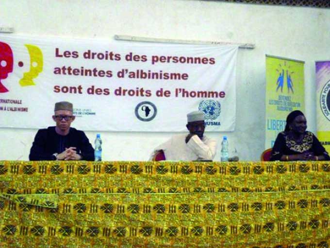 Sensibilisation à l'albinisme : Salif Kéita dénonce les crimes rituels dont les albinos sont victimes