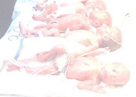 La malienne évacuée au Maroc a accouché par césarienne de 9 bébés au lieu de 7 attendus